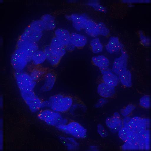 FISH image - Breast cells